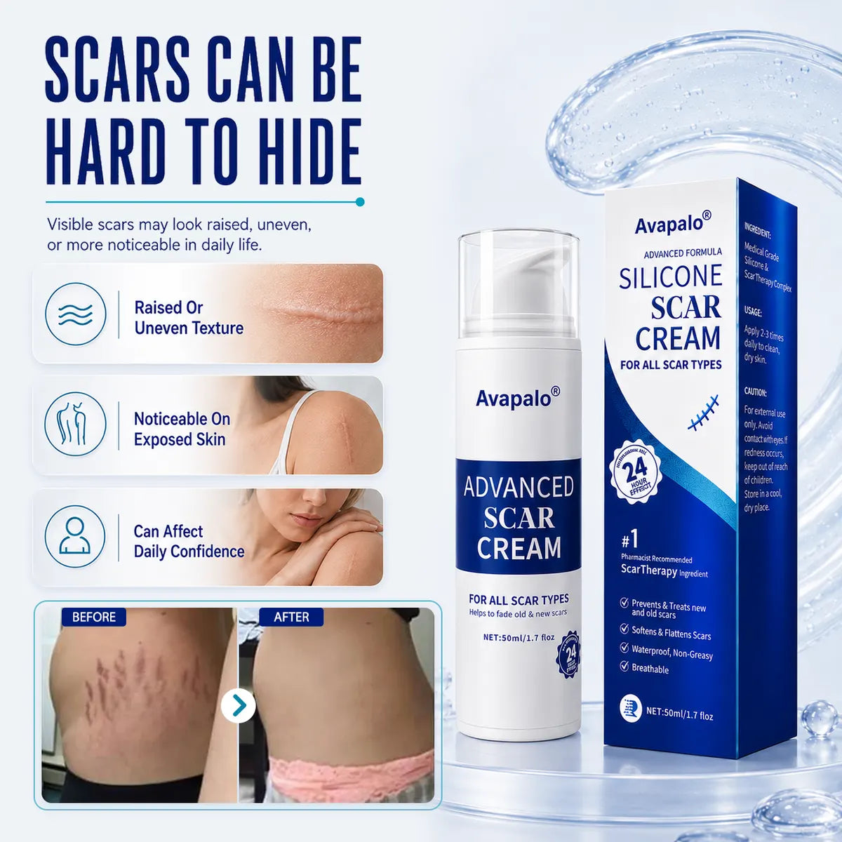 🌸Avapalo® Advanced Silicone Scar Gel – Professional Scar Removal Cream for Surgical Scars, Keloids, Stretch Marks, C-Section & Old or New Scars Repair Treatment (Copy)