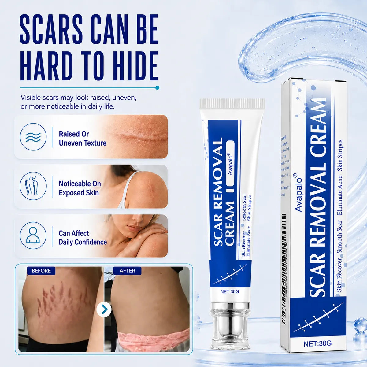 🌸Avapalo® Advanced Silicone Scar Gel – Professional Scar Repair Gel for Surgical Scars, Keloids, Stretch Marks, C-Section & Old or New Scars Treatment