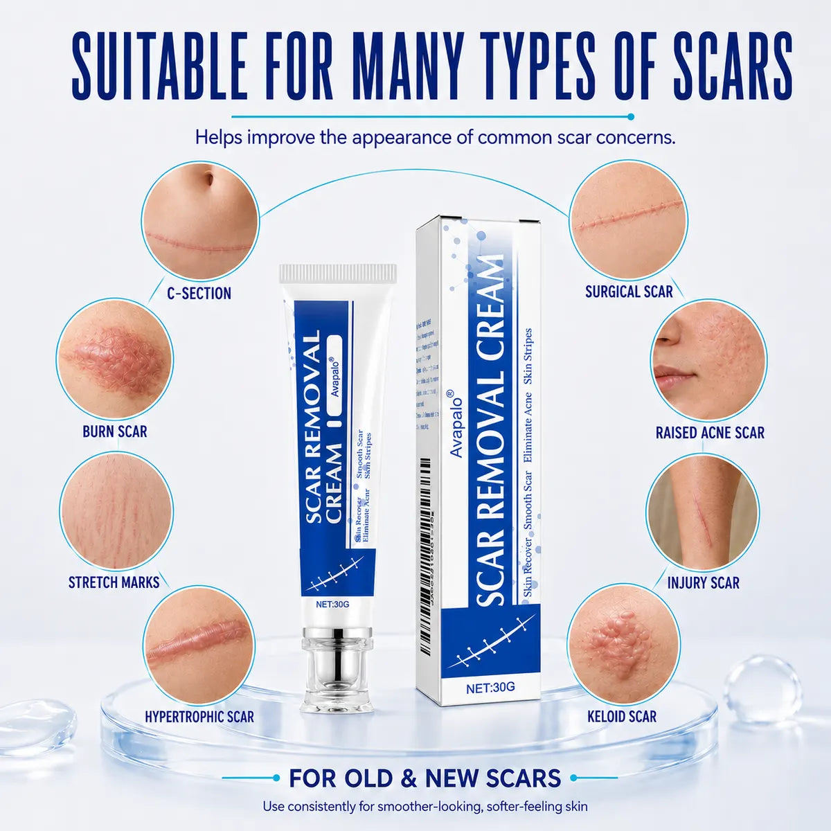 🌸Avapalo® Advanced Silicone Scar Gel – Professional Scar Repair Gel for Surgical Scars, Keloids, Stretch Marks, C-Section & Old or New Scars Treatment
