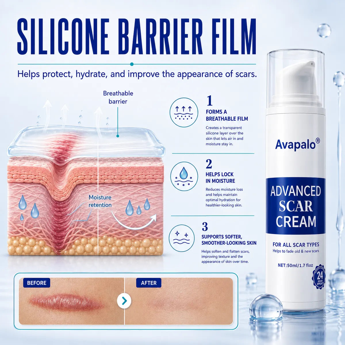 🌸Avapalo® Advanced Silicone Scar Gel – Professional Scar Removal Cream for Surgical Scars, Keloids, Stretch Marks, C-Section & Old or New Scars Repair Treatment (Copy)