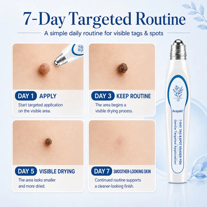 𝟕-𝐃𝒂𝘆 𝐒𝗸𝐢𝐧 𝐓𝒂𝗴 & 𝐒𝐩𝙤𝐭 𝐄𝐫𝒂𝐬𝙚𝐫 Painless & Scar-Free Advanced Imperfection Removal Rollerball Pen