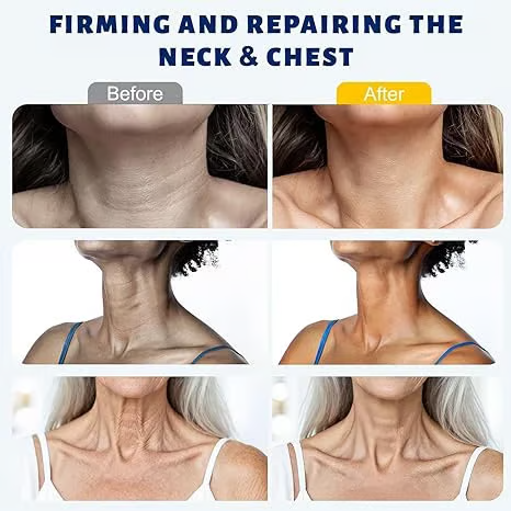 Avapalo® Roller Massage Neck Cream 🧴 Collagen & Hyaluronic Acid | Firms Neck, Reduces Wrinkles & Double Chin