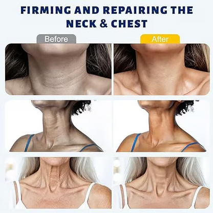 Avapalo® Roller Massage Neck Cream 🧴 Collagen & Hyaluronic Acid | Firms Neck, Reduces Wrinkles & Double Chin