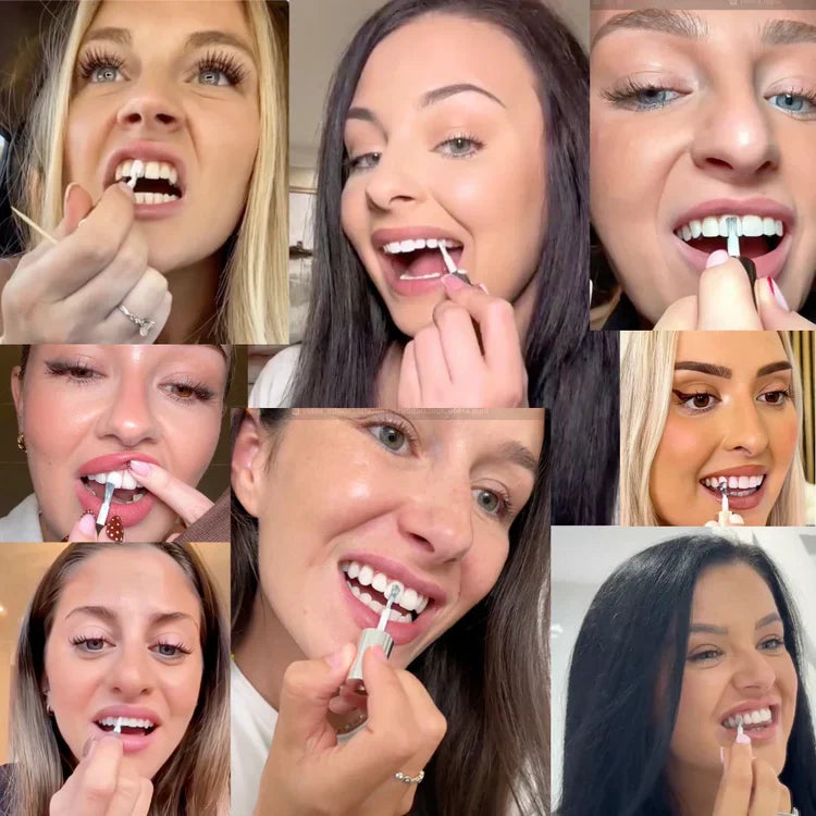 🦷Instant Teeth Whitening Polish  - Enamel Safe Tooth Gloss for Yellow Teeth Stain Removal - Fluoride-Free & Sensitivity Free