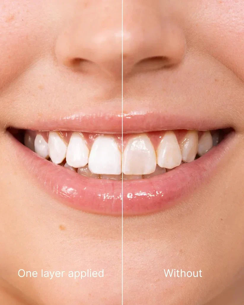 🆙🦷Instant Teeth Whitening Polish  - Enamel Safe Tooth Gloss for Yellow Teeth Stain Removal - Fluoride-Free & Sensitivity Free