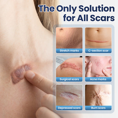 Avapalo® Advanced Scar Removal Cream — Say Goodbye to Stubborn Scars & Uneven Texture in 4 Weeks