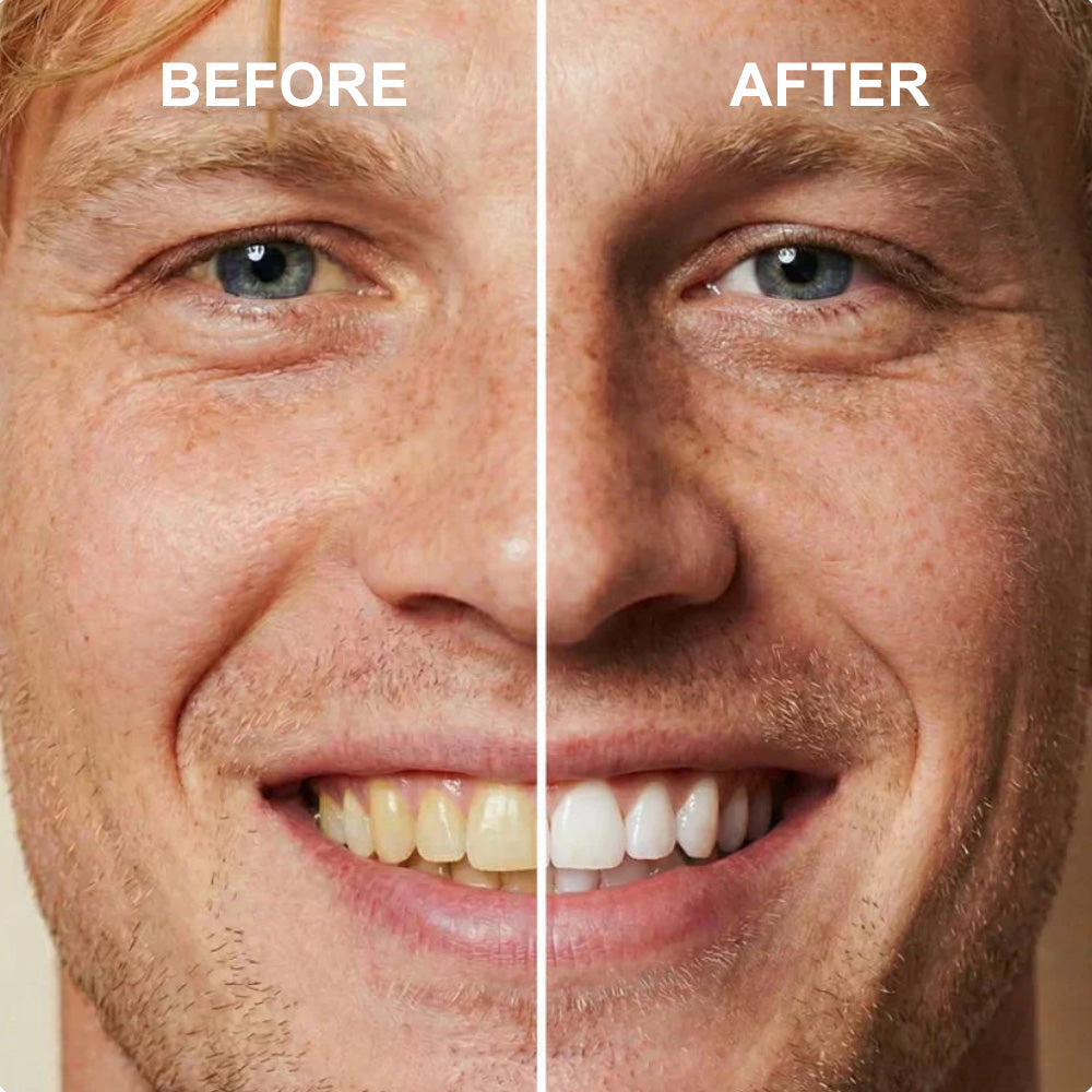 🦷Instant Teeth Whitening Polish  - Enamel Safe Tooth Gloss for Yellow Teeth Stain Removal - Fluoride-Free & Sensitivity Free