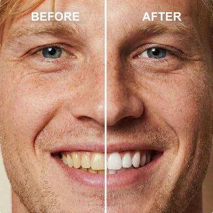 🦷Instant Teeth Whitening Polish  - Enamel Safe Tooth Gloss for Yellow Teeth Stain Removal - Fluoride-Free & Sensitivity Free