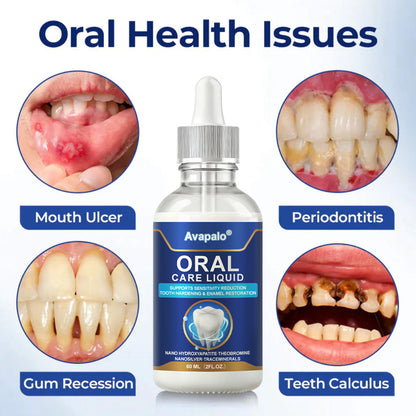 Avapalo® Oral Care Liquid– Effectively treats enamel damage, gum inflammation, toothaches, sensitive teeth, gum bleeding, periodontitis, cavities, mouth ulcers, and bad breath.