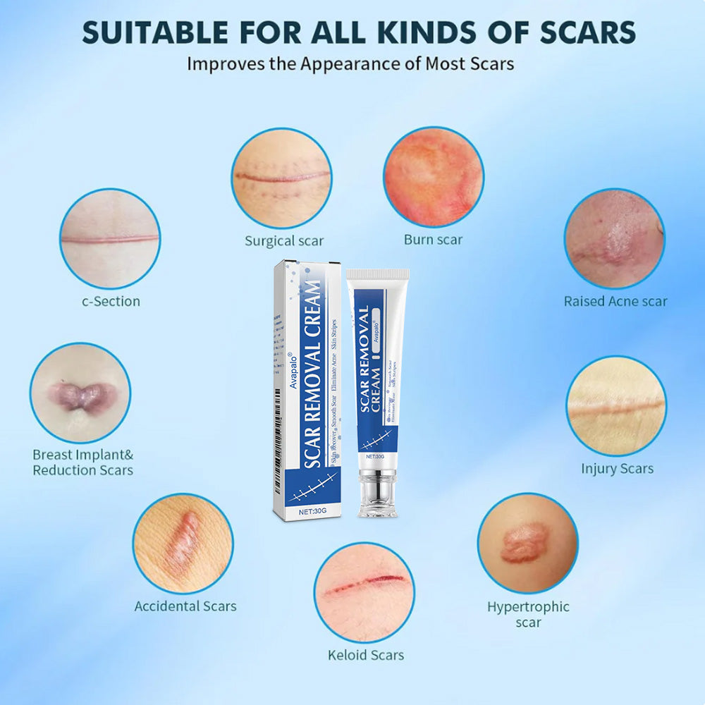 Avapalo® Advanced Silicone Scar Gel – Professional Scar Repair Gel for Surgical Scars, Keloids, Stretch Marks, C-Section & Old or New Scars Treatment