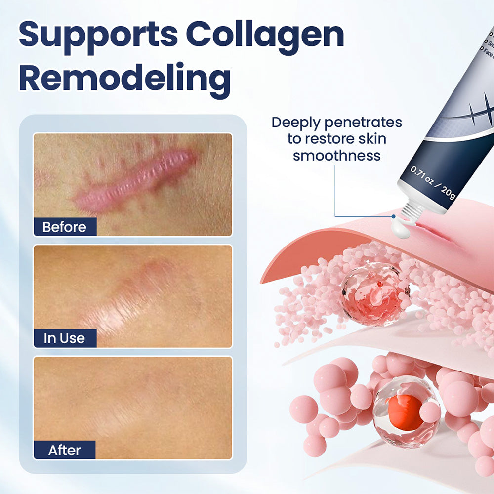 Avapalo® Advanced Scar Removal Cream — Say Goodbye to Stubborn Scars & Uneven Texture in 4 Weeks