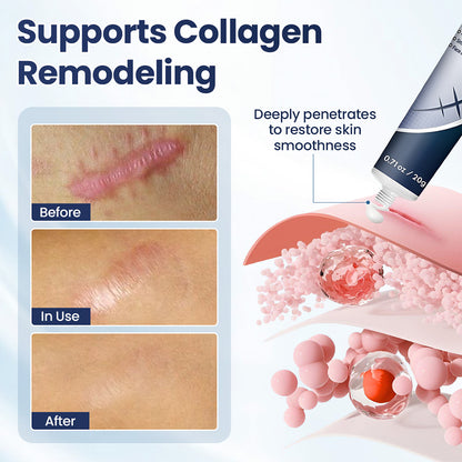 Avapalo® Advanced Scar Removal Cream — Say Goodbye to Stubborn Scars & Uneven Texture in 4 Weeks