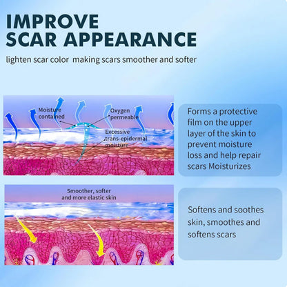 Avapalo® Advanced Silicone Scar Gel – Professional Scar Removal Cream for Surgical Scars, Keloids, Stretch Marks, C-Section & Old or New Scars Repair Treatment