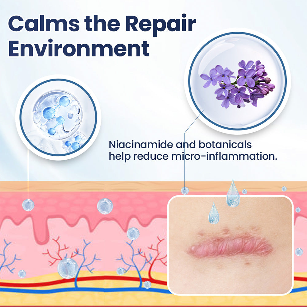 Avapalo® Advanced Scar Removal Cream — Say Goodbye to Stubborn Scars & Uneven Texture in 4 Weeks
