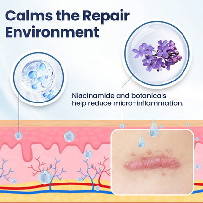 Avapalo® Advanced Scar Removal Cream — Say Goodbye to Stubborn Scars & Uneven Texture in 4 Weeks