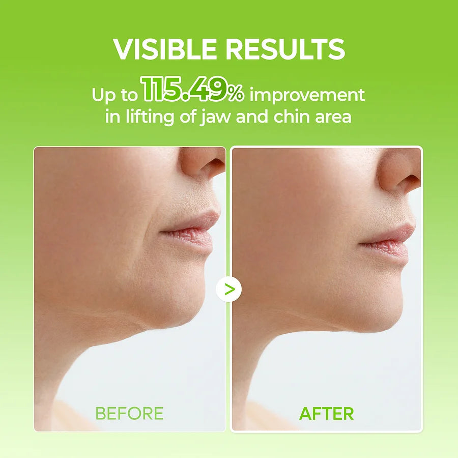 Avapalo® Cactus V-Lift Face Mask