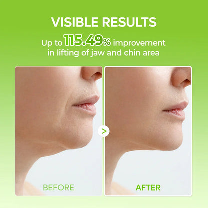 Avapalo® Cactus V-Lift Face Mask