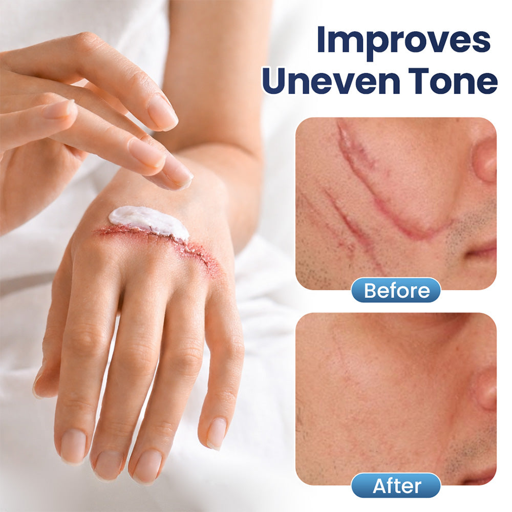 Avapalo® Advanced Scar Removal Cream — Say Goodbye to Stubborn Scars & Uneven Texture in 4 Weeks