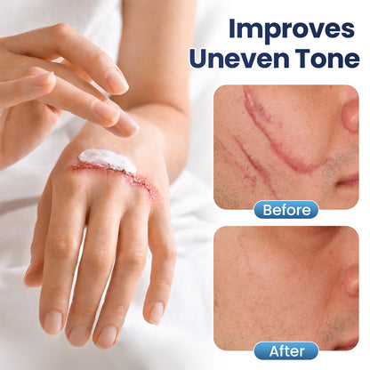 Avapalo® Advanced Scar Removal Cream — Say Goodbye to Stubborn Scars & Uneven Texture in 4 Weeks